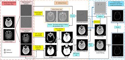 Multimodal brain image fusion based on error texture elimination and salient feature detection